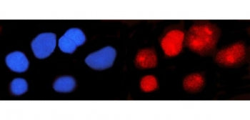 IFI16 Antibody / Gamma-interferon-inducible protein 16