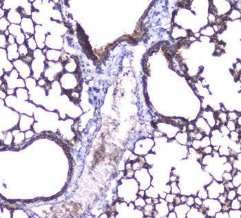 IHC staining of FFPE mouse lung with AQP5 antibody at 1ug/ml. HIER: boil tissue sections in pH6, 10m