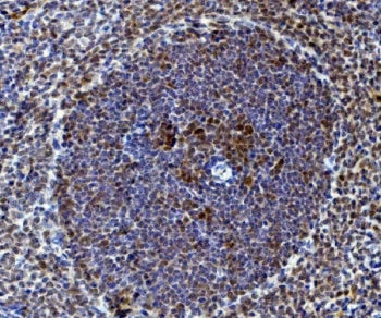 IHC staining of FFPE rat spleen with Rad9a antibody. HIER: boil tissue sections in pH8 EDTA for 20 m