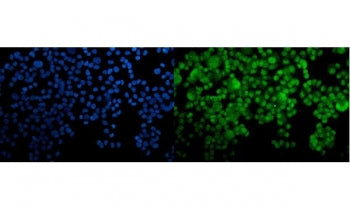 Immunofluorescent staining of FFPE human T-47D cells with HOXC10 antibody (green) and DAPI nuclear s