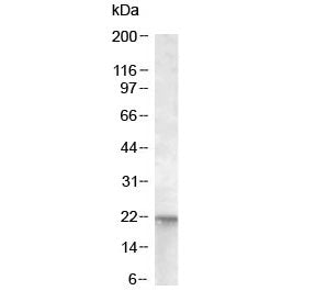 Western blot testing of human A431 lysate with NRAS antibody at 0.01ug/ml. Predicted molecular weigh