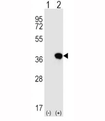Western blot analysis of HLA-G antibody and 293 cell lysate either nontransfected (Lane 1) or transi