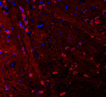 PSD-95 Antibody (PSD95)