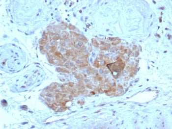 AMH Antibody / Anti-Muellerian Hormone