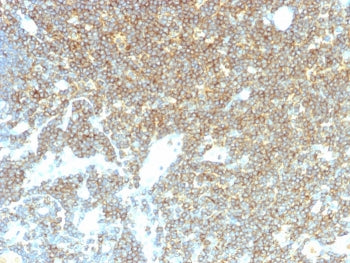 IHC staining of FFPE human lymph node with CD48 antibody (clone CD48/4785). HIER: boil tissue sections in pH 9 10mM Tris with 1mM EDTA for 20 min and allow to cool before testing.