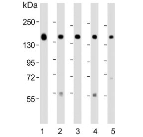 Western blot testing of human 1) MCF7, 2) HepG2, 3) T-47D, 4) mouse cerebellum and 5) human placenta