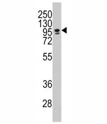 Western blot analysis of CEBPZ / CBF antibody and NCI-H460 lysate. Predicted molecular weight: ~120k