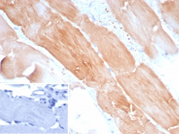 IHC staining of FFPE human skeletal muscle tissue with ACTN2 antibody (clone ACTN2/8184R). Inset: PB