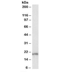 Western blot testing of MOLT4 lysate with eIF5A antibody at 0.1ug/ml. Predicted molecular weight: ~2