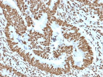ZNF846 Antibody