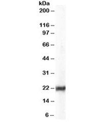 Western blot testing of HeLa lysate with HP1 antibody at 0.03ug/ml. Predicted molecular weight ~22kD