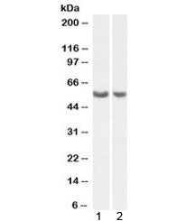 Western blot testing of human 1) lung and 2) ovary lysate with PTGIS antibody at 0.5ug/ml. Expected 