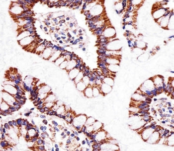 IHC testing of FFPE human small intestine tissue with ATP5B antibody. HIER: steam section in pH6 cit