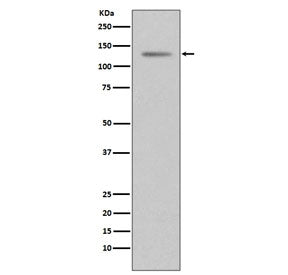 Western blot testing of human T-47D cell lysate with Progesterone Receptor antibody. Expected molecu