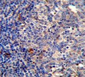 IHC testing of FFPE human tonsil tissue with BCL10 antibody. HIER: steam section in pH6 citrate buff