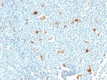 IHC: Formalin-fixed, paraffin-embedded human tonsil stained with Calprotectin antibody (CPT/1028)