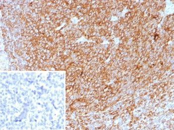 IHC staining of FFPE human tonsil tissue with HLA-DP/DQ/DR antibody (clone HLA-Pan/8622R). Inset: PB