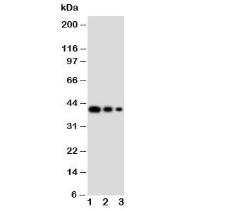 Western blot testing of GATA2 antibody and Lane 1: recombinant human protein 10ng; 2: 5ng; 3: 2.5ng