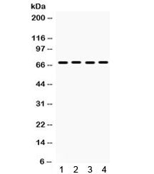 Western blot testing of 1) rat lung, human 2) HeLa, 3) A549 and 4) SW620 lysate with ETV4 antibody. 