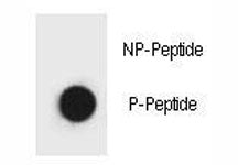 Dot blot analysis of phospho Beclin-1 antibody. 50ng of phos-peptide or nonphos-peptide per dot were