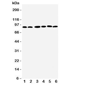 Western blot testing of RSK1 antbody; Lane 1: MCF-7; 2: HeLa; 3: K562; 4: Jurkat; 5: SW620; 6: Raji 