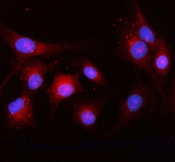 Immunofluorescent staining of FFPE human A549 cells with OSBPL10 antibody (red) and DAPI nuclear sta