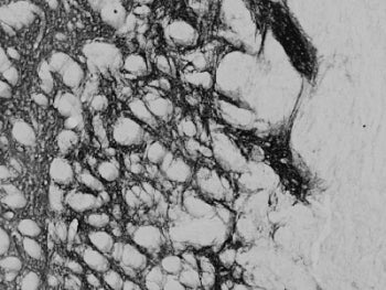 IHC testing of a PFA-perfused cryosection of rat striatum with PENK antibody at 0.02ug/ml. HRP-stain