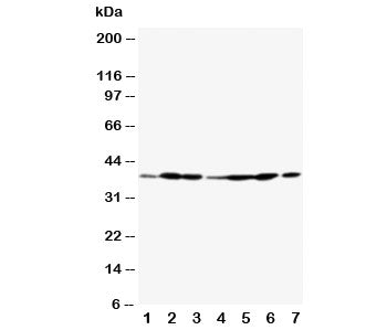 Annexin A2 Antibody