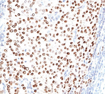 Progesterone Receptor Antibody