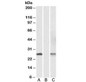 Western blot of HEK293 lysate overexpressing human DYDC1-MYC lysate (Lane A) and mock-transfected ly