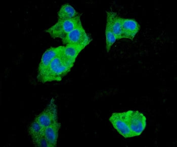 EEF2 Antibody / Elongation factor 2