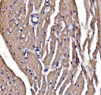 IHC staining of FFPE mouse heart tissue with Myosin Heavy Chain 3 antibody. HIER: boil tissue sectio