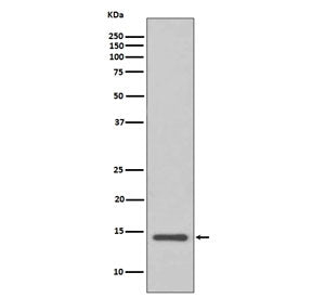 Western blot testing of human HeLa cell lysate with Cystatin C antibody. Predicted molecular weight 
