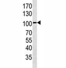 GPR49 antibody western blot analysis in HepG2 lysate