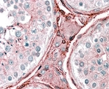 IHC testing of FFPE human testis with CYBRD1 antibody at 2.5ug/ml. HIER: steamed with pH6 citrate buffer, AP-staining.