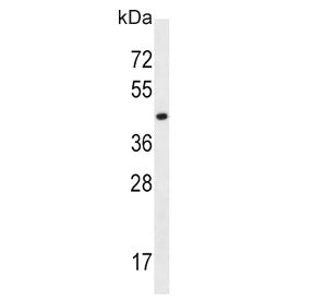 Western blot testing of human K562 cell lysate with MCT10 antibody. Predicted molecular weight ~55 k