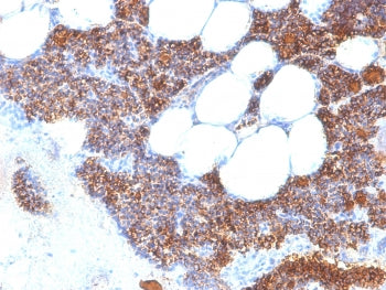 IHC testing of FFPE human parathyroid gland stained with recombinant PTH antibody (clone PTH/2295R).