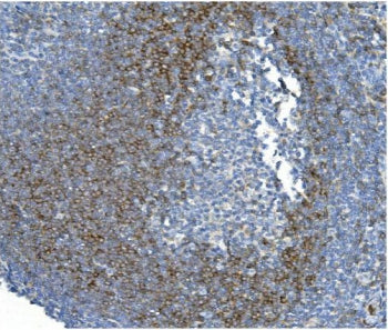 IHC staining of FFPE human tonsil with CD79b antibody. HIER: boil tissue sections in pH8 EDTA for 20