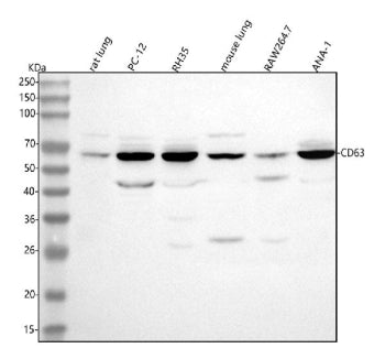 Western blot analysis of Cd63 using anti-Cd63 antibody. Lane 1: rat lung tissue lysates, Lane 2: rat