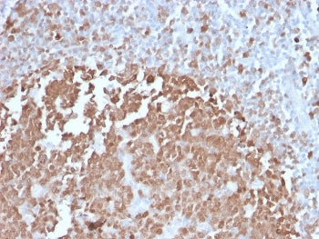 IHC testing of FFPE human tonsil with BOB.1 antibody. HIER: boil tissue sections in pH 9 10mM Tris w