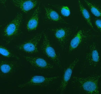 Immunofluorescent staining of FFPE human U-2 OS cells with PLA2G6 antibody (green) and DAPI nuclear 