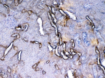 Vegf receptor 2 Antibody / Vegfr2 / Kdr