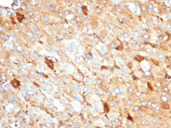 Albumin Antibody / ALB