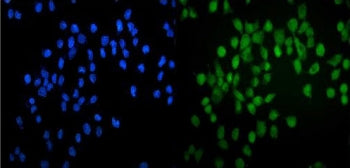 Immunofluorescent staining of FFPE human A431 cells with GATA2 antibody (green) and DAPI nuclear sta