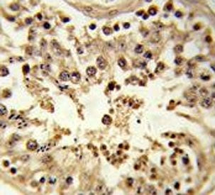 CDC42EP3 Antibody