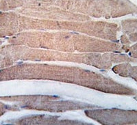 IHC testing of FFPE human skeletal muscle tissue with Death-associated protein kinase 2 antibody. HI