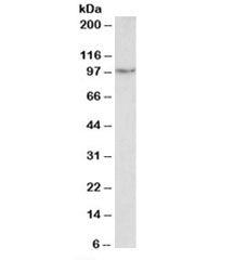 Western blot testing of human uterus lysate with PDE4B antibody at 2ug/ml. Predicted molecular weigh
