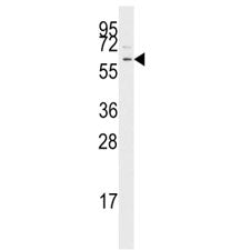Western blot analysis of TGF Beta Receptor antibody and Jurkat lysate. Predicted molecular weight: ~