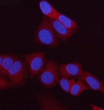 HIP Antibody HSC70 Interacting Protein