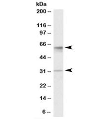 Western blot testing of human placenta lysate with SLC17A5 antibody at 1ug/ml. Predicted molecular w